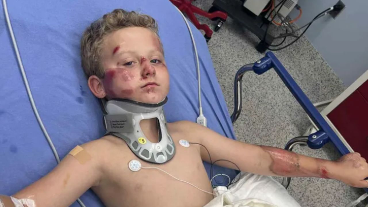 8-Year-Old Boy Recovering After Hit-and-Run Bicycle Accident in Fort Worth